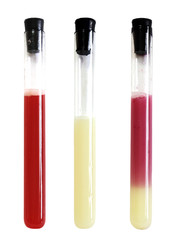 laboratory apparatus with colorful solution chemistry flask expe