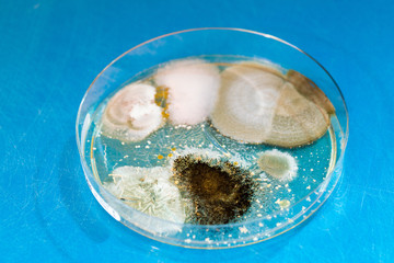 Petri dish