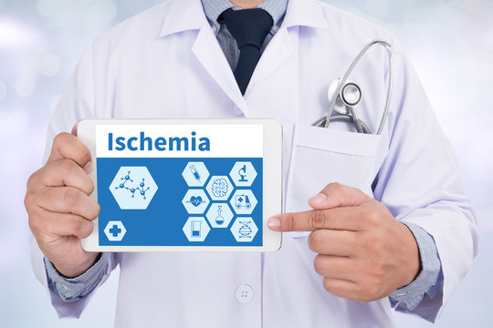 Ischemia