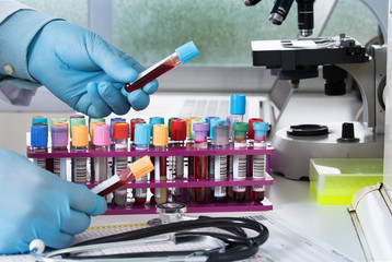 hands of a lab technician holding blood tubes sample for study / hands doctor holding blood testing...