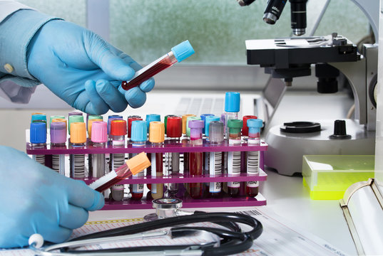 hands of a lab technician holding blood tubes sample for study / hands doctor holding blood testing of rack in the laboratory 