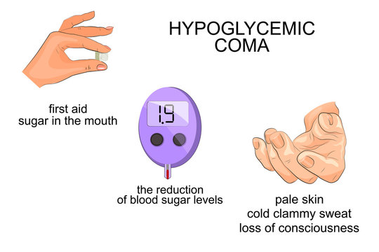 symptoms and help with hypoglycemic coma