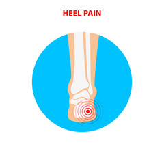 Heel pain. Human ankle joint icon back view. Vector illustration