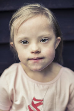 Thoughtful girl with down syndrome looking away