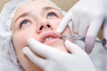 Procedure of lip injection with filler.