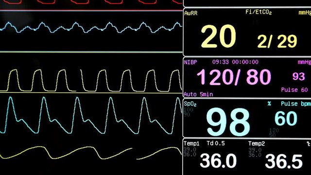 Modern echocardiography (ultrasound) machine monitor. New hospitl equipment.  Measuring pusle.