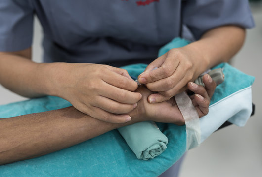 asian anesthesiologist made arterial line