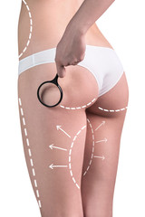 Woman buttocks with cellulite and magnifier