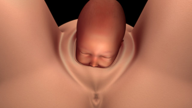 Normal labor and vaginal birth