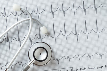 Stethoscope on the ECG. medical symbolic close-up photo
