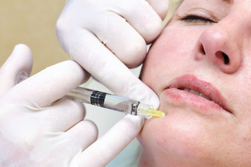 Anti-age injection therapy. Mimic wrinkles reduction.