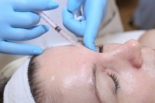 Anti-age injection therapy. Mimic wrinkles reduction.