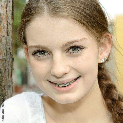 Teen Mit Zahnspange Teen Mit Zahnspange