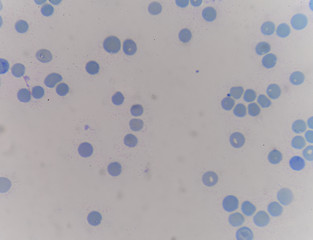 reticulocyte