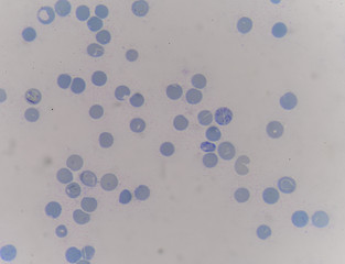 reticulocyte
