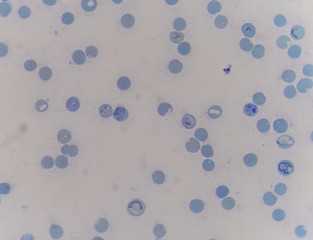 reticulocyte
