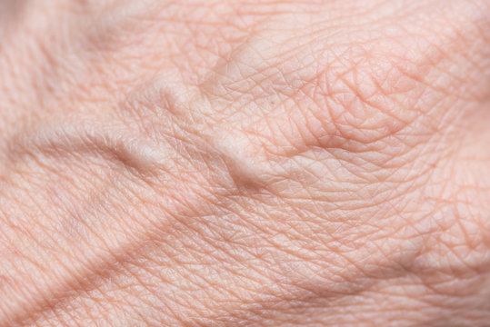 Faltige Haut am Handrücken mit Adern durchzogen