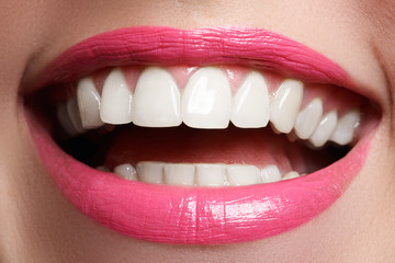 Macro happy woman's smile with healthy white teeth, bright pink .lips make-up. Stomatology and beauty care. Woman smiling with great teeth. Cheerful female smile with fresh clear skin


