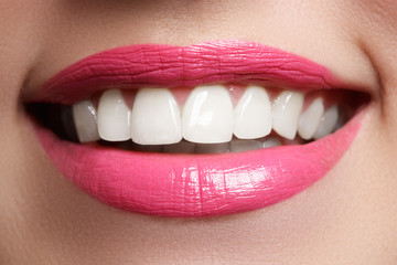 Macro happy woman's smile with healthy white teeth, bright pink .lips make-up. Stomatology and beauty care. Woman smiling with great teeth. Cheerful female smile with fresh clear skin

