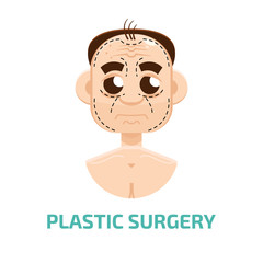 Plastic surgery man