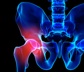 Hip painful skeleton x-ray, 3D illustration.