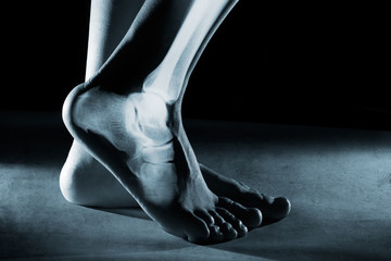 Fototapeta Human foot ankle and leg in x-ray obraz