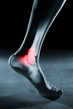Human foot ankle and leg in x-ray