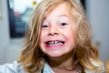 little funny girl with retainer - obrazy, fototapety, plakaty