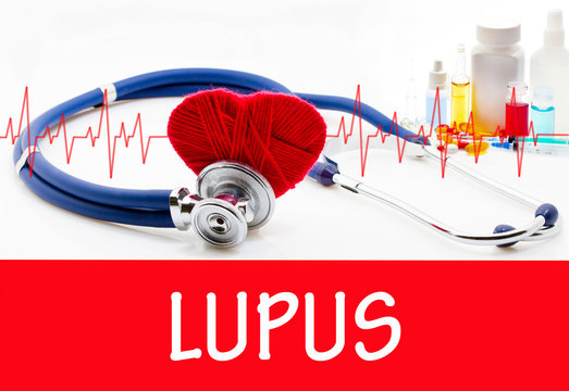 Lupus