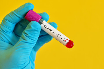 Blood sample positive with Lassa virus test
