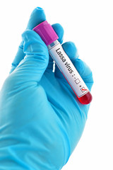 Blood sample positive with Lassa virus test
