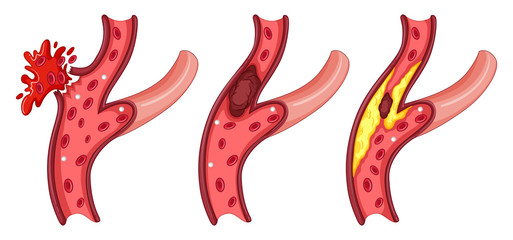Symptoms in human vein