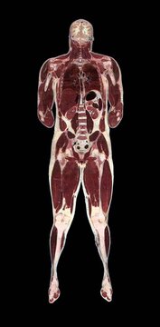 Composite image of human male anatomy