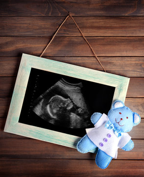 Vintage frame with ultrasound scan of baby on wooden background