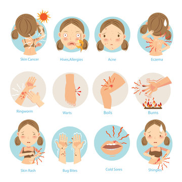 Skin Problems/Most people are a common skin problem.Vector  illustrations.