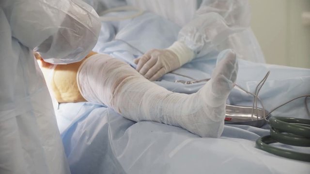 the patient's leg during hip surgery in the hospital. doctors operate on a patient. transplantation of joint.