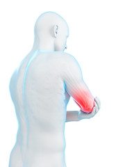 medically accurate 3d illustration of elbow pain