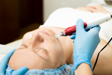 Beautician makes fractional mesotherapy to young woman. The cosmetic procedures for the face....