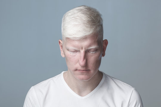 Albino man with closed eyes against gray background