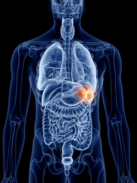 3d rendered, medically accurate illustration of spleen cancer