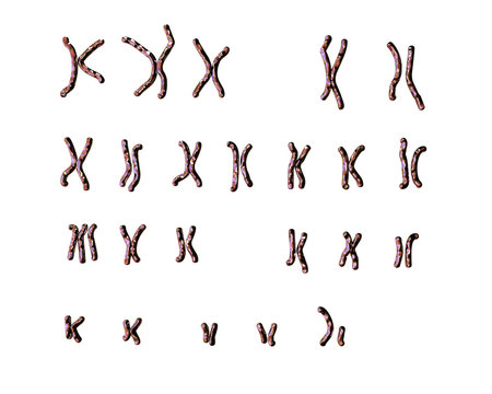 Patau-syndrome male karyotype, unlabeled. Trisomy 13. 3D illustration
