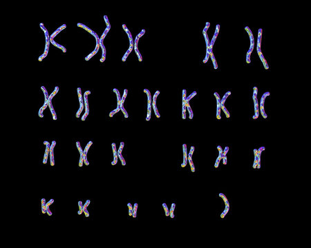 Turner&rsquo;s-syndrome karyotype, unlabeled. X0 karyotype. 3D illustration