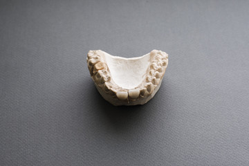 Plaster jaw with two dentures on gray background flat lay. Dentist work equipment for selection right dentures for patient. Top view on plaster jaw with dentures. Stomatology background