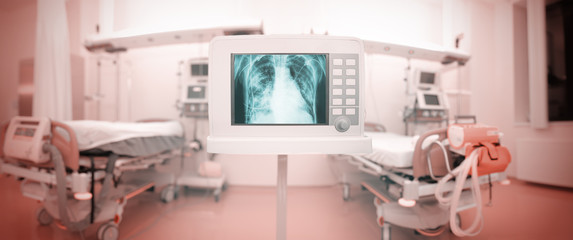 X-ray monitor in panoramic ICU ward