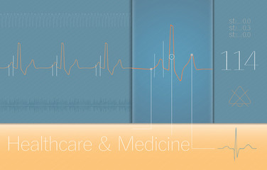 ECG complexes Medical on monitor screen