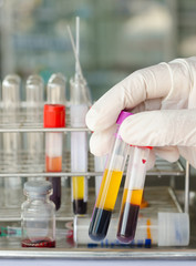 Technician scientist's hand in rubber gloves holding centrifuged blood in glass tube, laboratory medical concept.