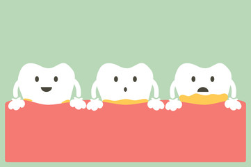 periodontal disease with plaque or tartar