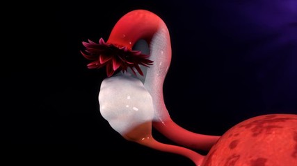 Endometriosis Adhesions