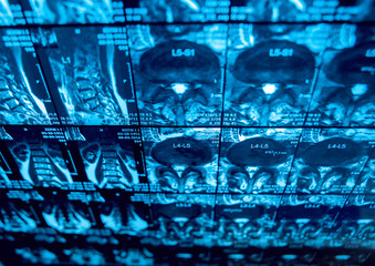 Medical equipment. MRI picture.