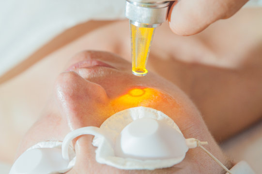 laser skin treatment / Woman undergoing laser skin treatment